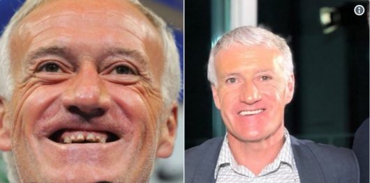 Didier Deschamps s'offre une nouvelle dentition et fait un buzz énorme sur la toile !