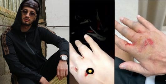 Soolking blessé après une grosse chute en buggy à Dubai, il rassure les fans