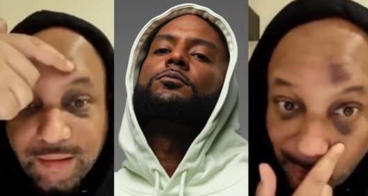 Booba pique Matt Houston qui clame sa vengeance le visage recouvert d'hématomes