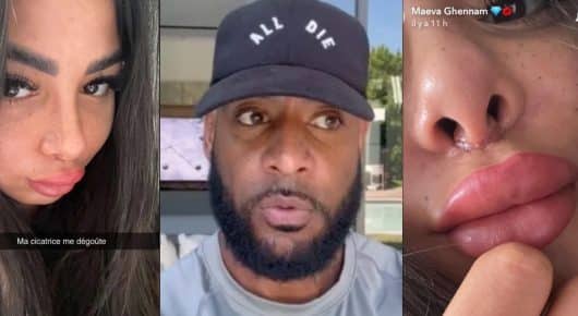 Booba ridiculise Maeva Ghennam qui vit un cauchemar avec sa chirurgie ratée